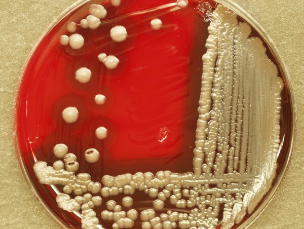 BACILLUS LICHENIFORMIS